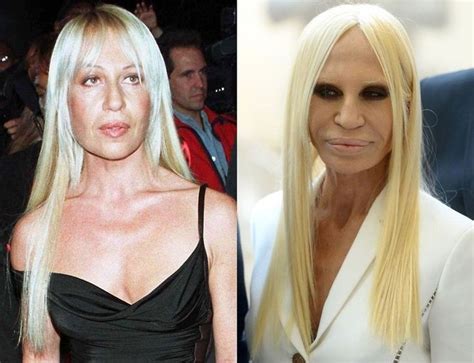 donatela versace jeune|Donatella Versace plastic surgery.